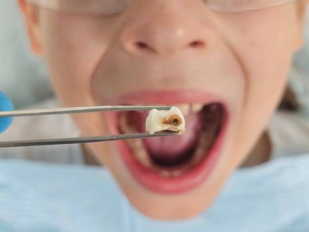 Best Cracked Tooth Emergency Dentist  in Greenbriar, VA